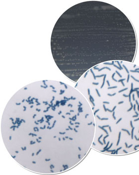 超低栄養性細菌 Rhodococcus erythropolis N9T-4株